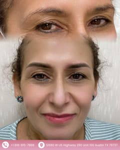 Eyebrow Tattoo result by Beautydreamsbylynn in Austin, TX