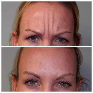 Eyebrow Tattoo result by Bella Cosmedica in Pickerington, OH