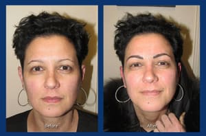 Eyebrow Tattoo result by Best Permanent Makeup By Jeffery Lyle Segal in Glenview, IL