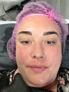 Eyebrow Tattoo result by Biocosmetica International in Maryville, TN