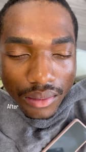Eyebrow Tattoo result by Bling Bling Microblading & Permanent Makeup in Plano, TX
