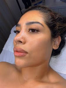 Eyebrow Tattoo result by Bloom Studio by Caro in Winter Garden, FL