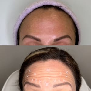 Eyebrow Tattoo result by Bloomhaus Medspa & Wellness - Miramar in Miramar, FL