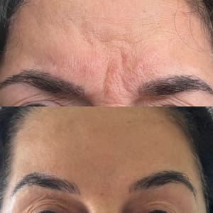 Eyebrow Tattoo result by Bloomhaus Medspa & Wellness - Miramar in Miramar, FL
