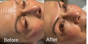 Eyebrow Tattoo result by Bon Brow in Aliso Viejo, CA