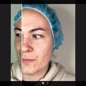 Eyebrow Tattoo result by Boudoir Skin & Beauty Bar in Marlow Heights, MD