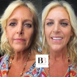 Eyebrow Tattoo result by Bougie Brows in Rohnert Park, CA