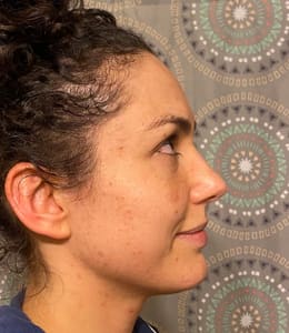 Eyebrow Tattoo result by Boulder Aesthetics in Boulder, CO