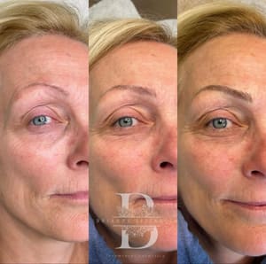 Eyebrow Tattoo result by Brianne Elizabeth PMU in Quincy, MA