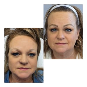 Eyebrow Tattoo result by Brow and Image Renewal in Abilene, TX