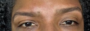 Eyebrow Tattoo result by Brow Bar Raleigh in Raleigh, NC
