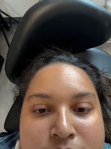 Eyebrow Tattoo result by Brow Lane in Royal Palm Beach, FL