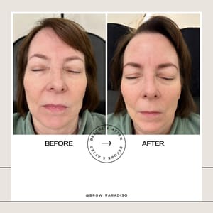 Eyebrow Tattoo result by Brow Paradiso in Hinsdale, IL