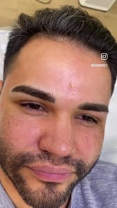 Eyebrow Tattoo result by Brow Rey in Temple City, CA