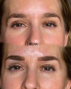 Eyebrow Tattoo result by Brow.RN_ in Minneapolis, MN