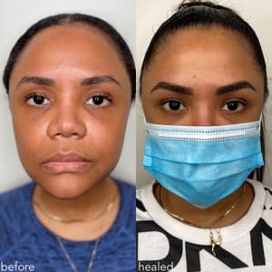 Eyebrow Tattoo result by BrowHaus Cosmetic Tattoo in Richfield, MN