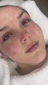 Eyebrow Tattoo result by BrowLady in Dallas, TX