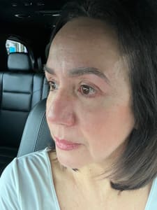Eyebrow Tattoo result by Browmetrics in Miami, FL