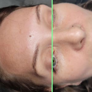 Eyebrow Tattoo result by Brows and Beyond by Carol in Sebring, FL