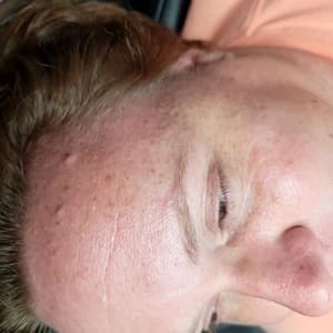 Eyebrow Tattoo result by Brows and Beyond by Carol in Sebring, FL