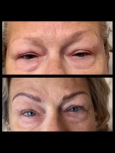 Eyebrow Tattoo result by Brows & Beyond in Leesburg, FL