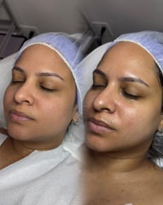Eyebrow Tattoo result by brows by sol in Mount Vernon, NY