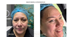 Eyebrow Tattoo result by Brows & Lashes by Vanessa in Brentwood, CA