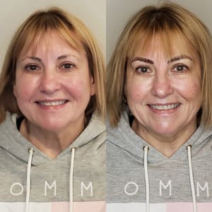 Eyebrow Tattoo result by Brows, Lips, etc. in Lynnwood, WA