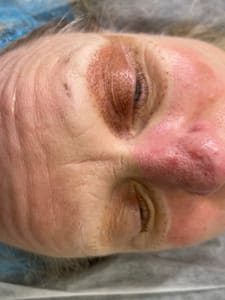 Eyebrow Tattoo result by BrowsbyDana Eyeliner SMP Sacramento Elk Grove CA in Elk Grove, CA