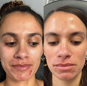 Eyebrow Tattoo result by Busa Aesthetics in Burlington, NC