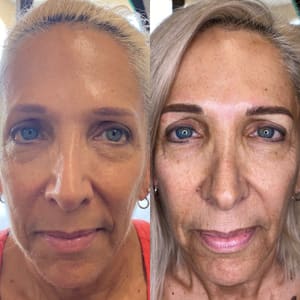 Eyebrow Tattoo result by Charlene Davis PMU in St Augustine, FL
