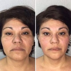 Eyebrow Tattoo result by Cryo Face and Body Sculpting in Huntington Beach, CA