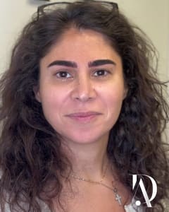 Eyebrow Tattoo result by D Atelier in Arlington Heights, IL