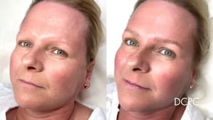 Eyebrow Tattoo result by David Chum Personal Cosmetics in Belmont, MA