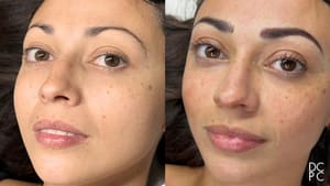 Eyebrow Tattoo result by David Chum Personal Cosmetics in Belmont, MA