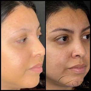 Eyebrow Tattoo result by Define Brow Studio in Irvine, CA