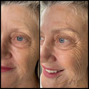 Eyebrow Tattoo result by Define Brow Studio in Irvine, CA