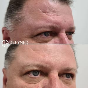 Eyebrow Tattoo result by Defyned Aesthetics in Pearland, TX