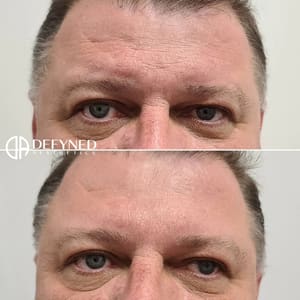 Eyebrow Tattoo result by Defyned Aesthetics in Pearland, TX