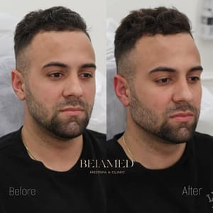 Eyebrow Tattoo result by Deluxe Brows Miami in Miami, FL