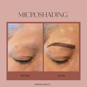 Eyebrow Tattoo result by Derma Dolce in Albuquerque, NM