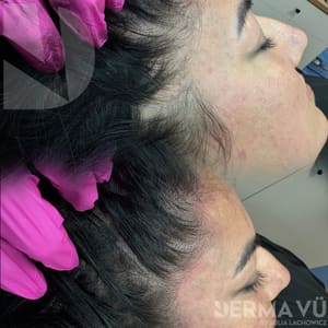 Eyebrow Tattoo result by DermaVu by Julia Lachowicz in Indiantown, FL