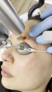Eyebrow Tattoo result by DMV Laser Beauty Clinic in Tysons, VA