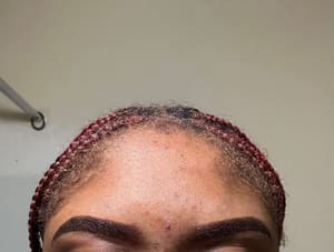Eyebrow Tattoo result by Dream Brows NYC in Brooklyn, NY