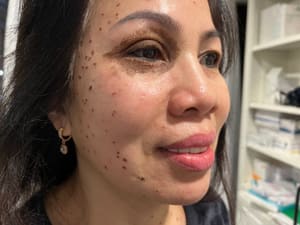 Eyebrow Tattoo result by Dynamic Permanent Makeup in Oklahoma City, OK