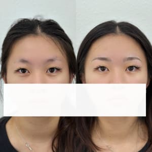 Eyebrow Tattoo result by Eclipse beauty studio in Chino Hills, CA