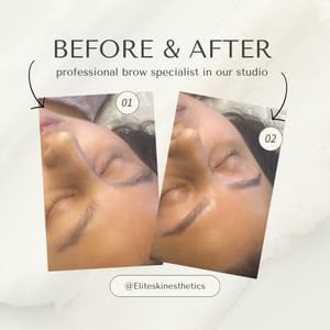 Eyebrow Tattoo result by Elite Skin Esthetics in Springfield, MA