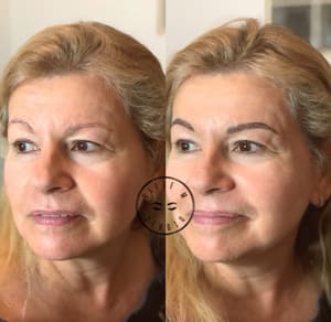 Eyebrow Tattoo result by Ellie Brows & Beauty in Miami, FL