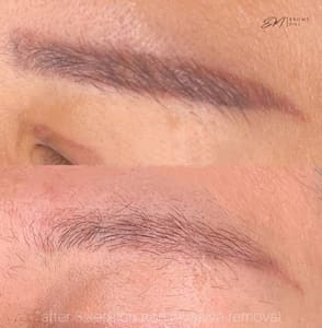 Eyebrow Tattoo result by Em Brows_pmu in Santa Monica, CA