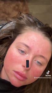 Eyebrow Tattoo result by Enhanced Beauty Design in Mt Sinai, NY